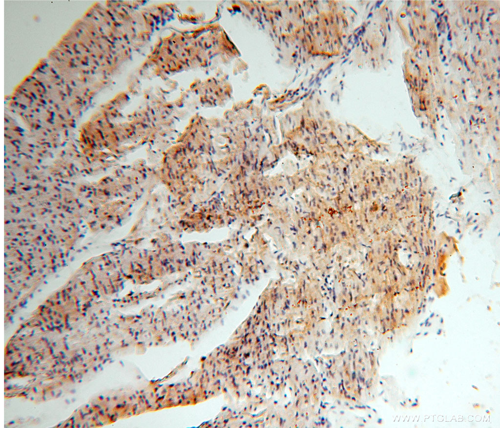 IHC staining of human heart using 14793-1-AP