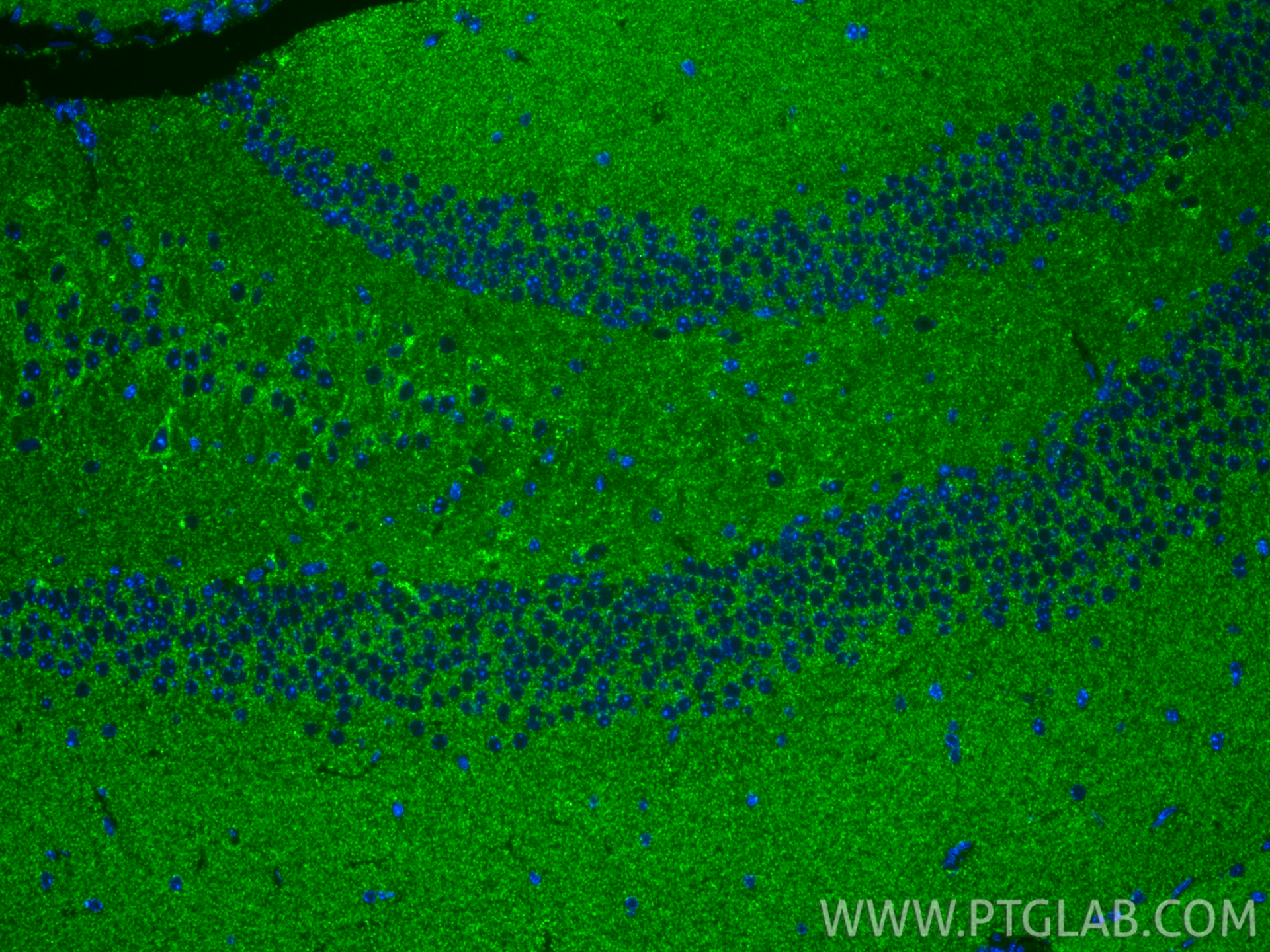 IF Staining of mouse brain using 10756-1-AP IF Staining of mouse brain using 10756-1-AP