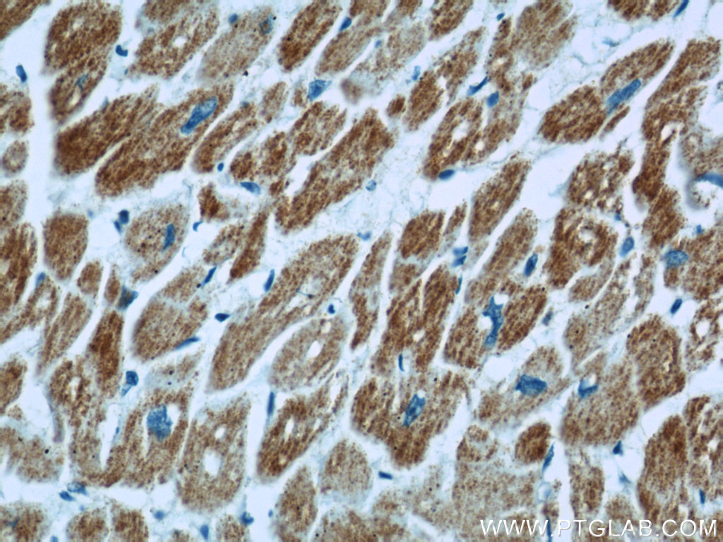 IHC staining of human heart using 21705-1-AP