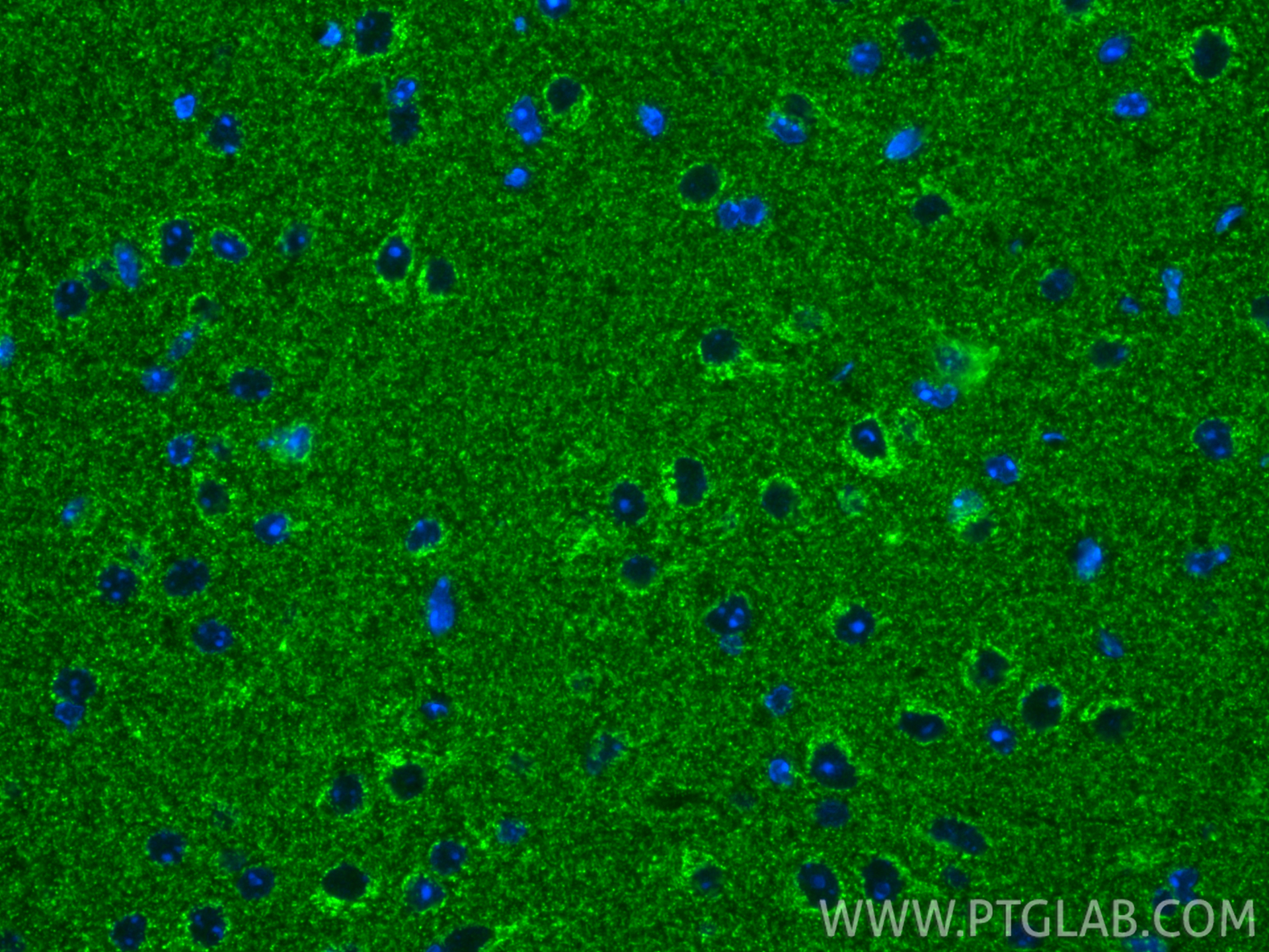 IF Staining of mouse brain using 67888-1-Ig IF Staining of mouse brain using 67888-1-Ig