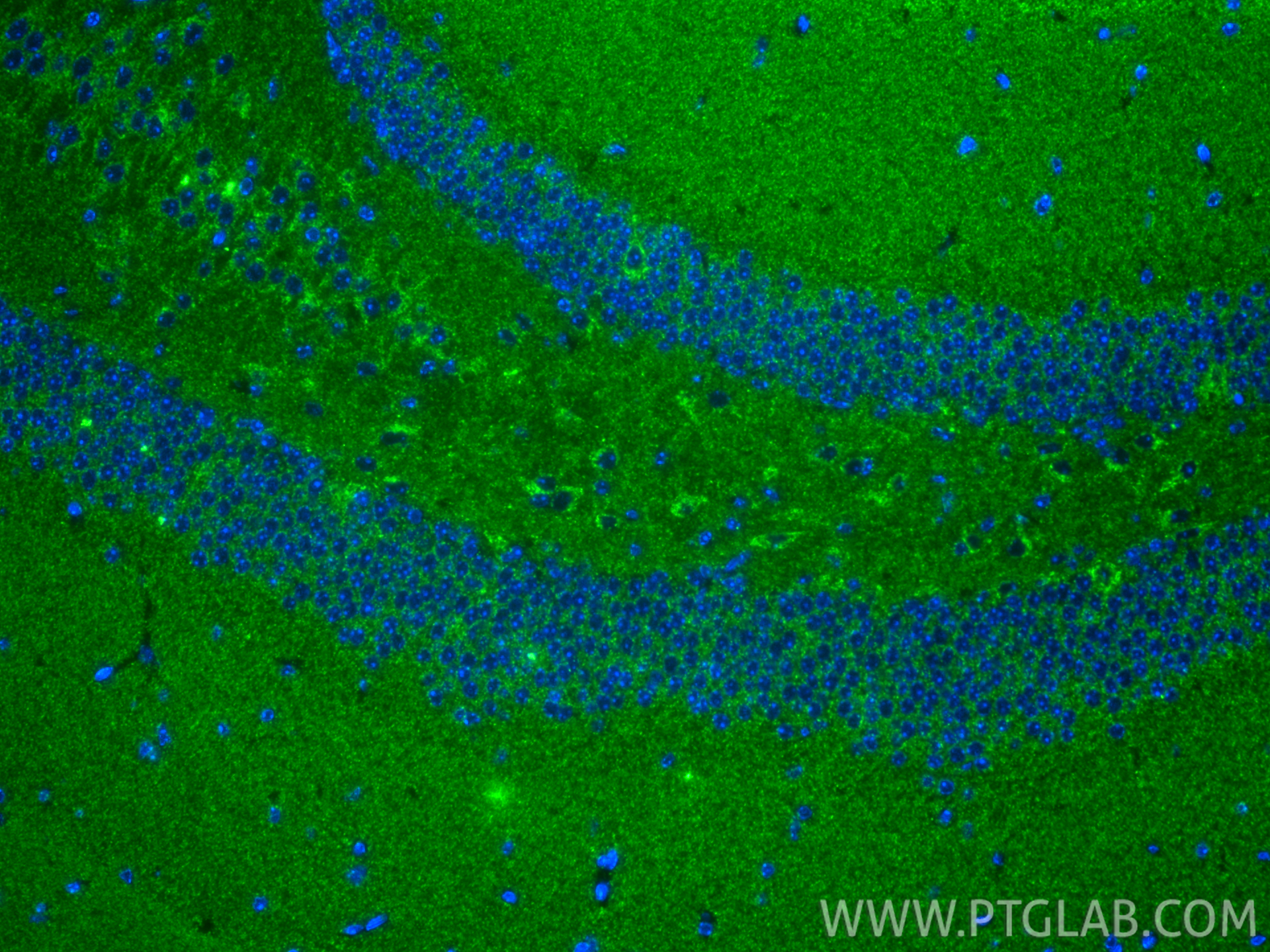IF Staining of mouse brain using 83671-2-RR IF Staining of mouse brain using 83671-2-RR