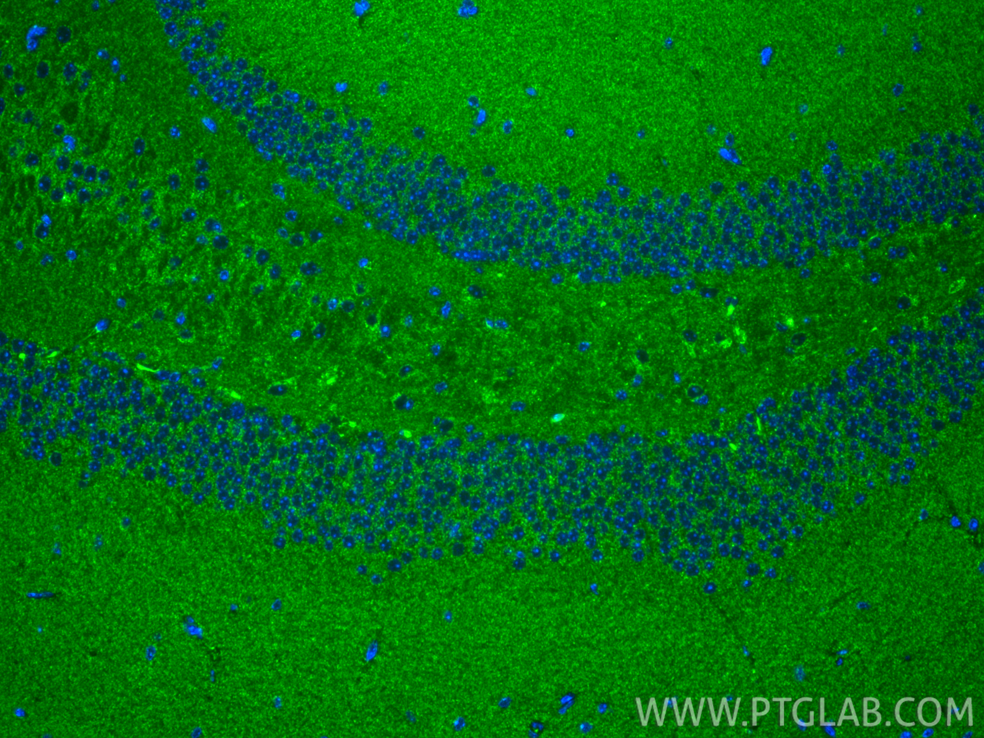 IF Staining of mouse brain using 67547-1-Ig