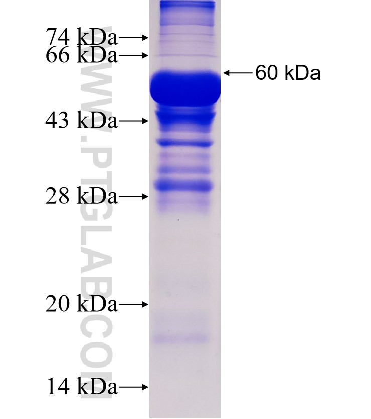UQCRC2 fusion protein Ag6432 SDS-PAGE