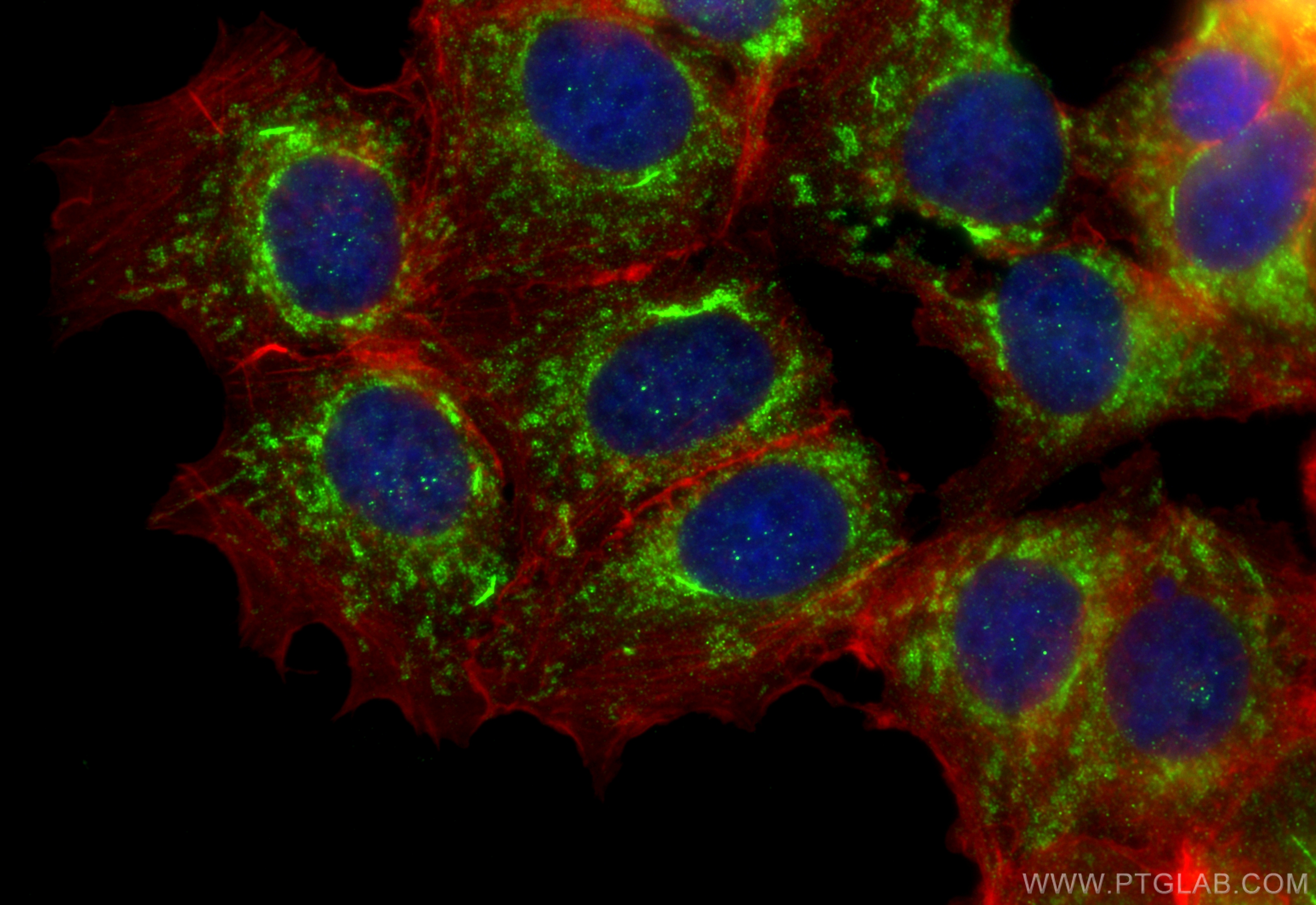 IF Staining of MCF-7 using 18443-1-AP