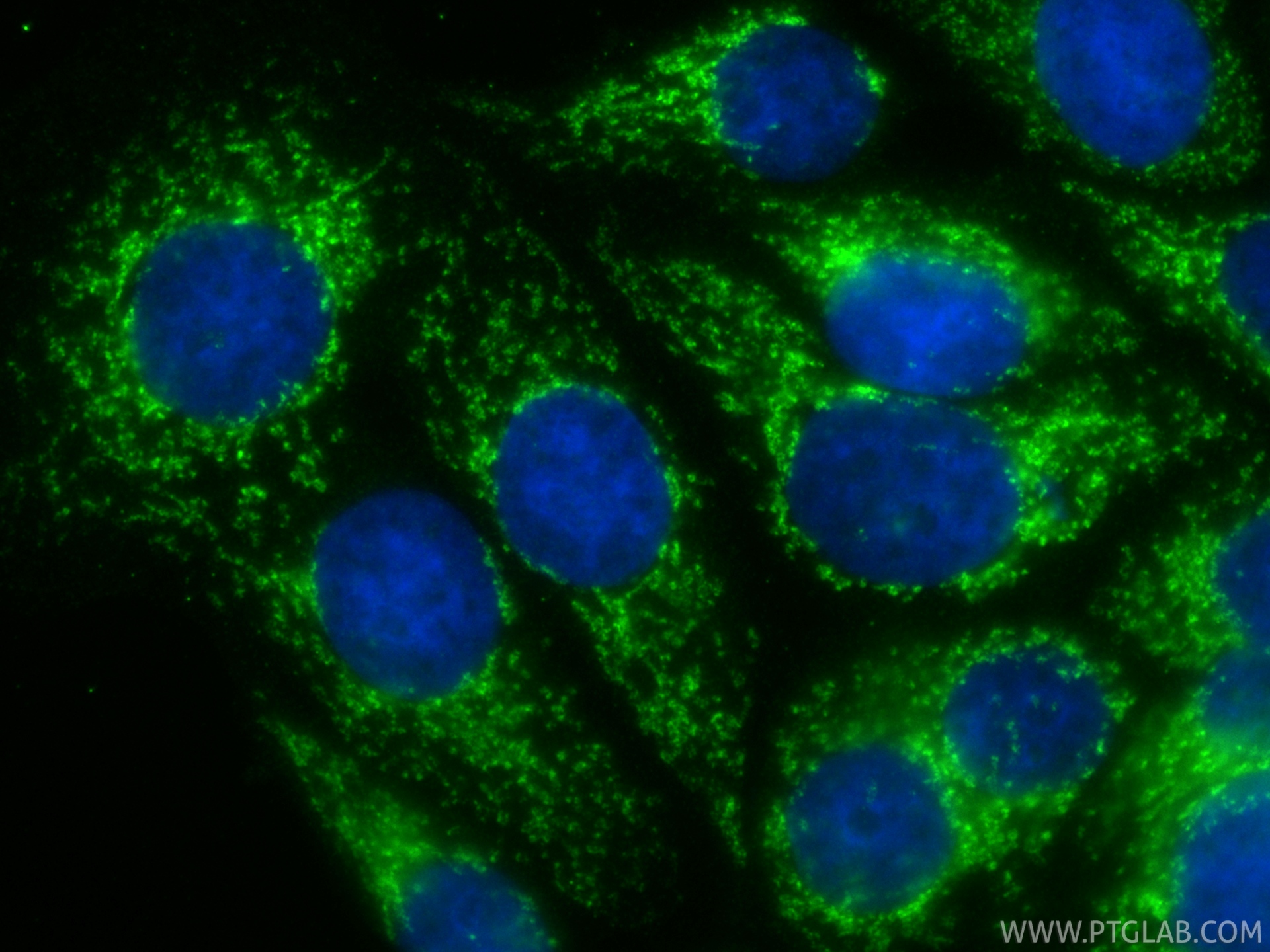 IF Staining of MCF-7 using 88500-1-RR