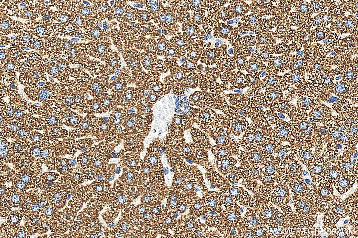 IHC staining of mouse liver using 88500-1-RR (same clone as 88500-1-PBS) IHC staining of mouse liver using 88500-1-RR (same clone as 88500-1-PBS)
