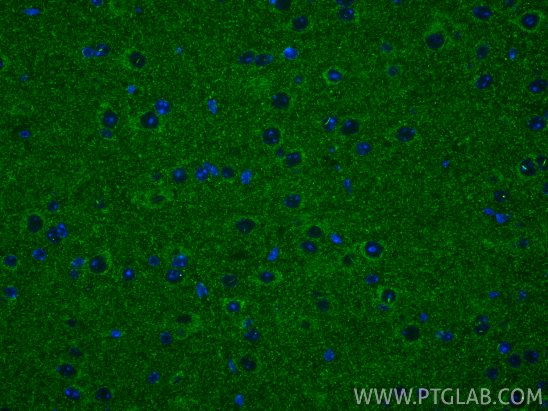 IF Staining of mouse brain using 12364-1-AP IF Staining of mouse brain using 12364-1-AP