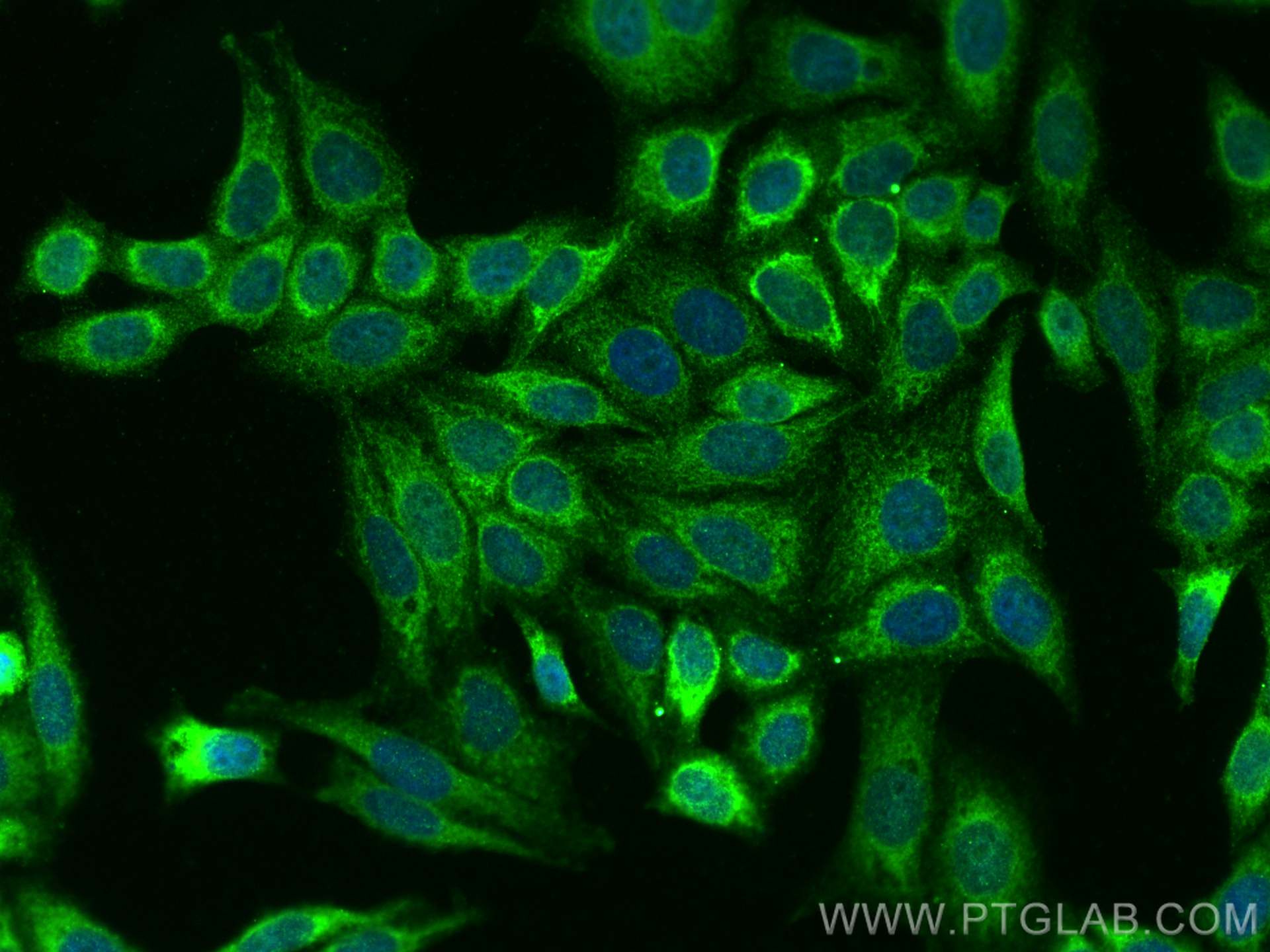 IF Staining of HepG2 using 14975-1-AP