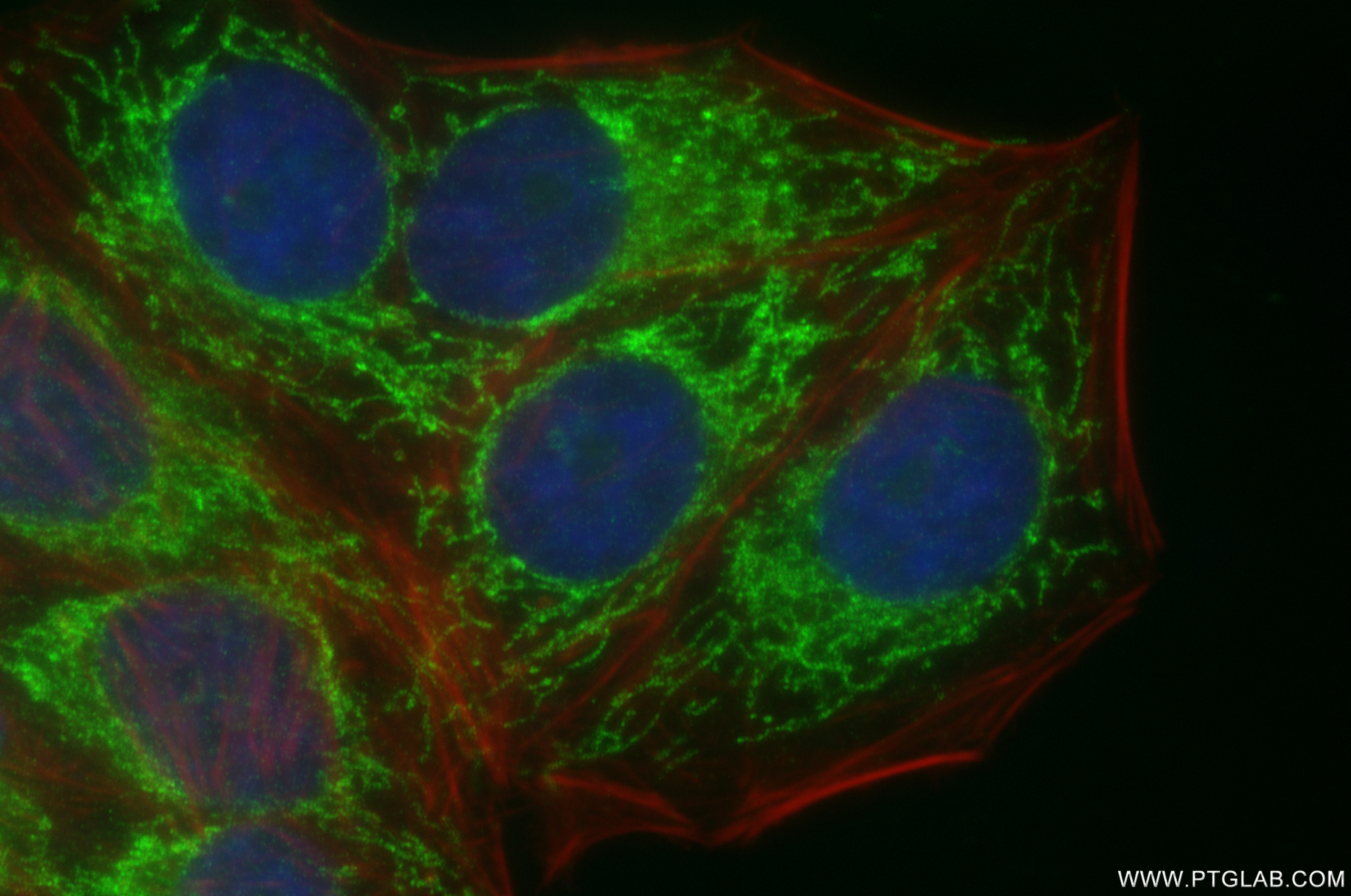 IF Staining of HepG2 using 87199-1-RR