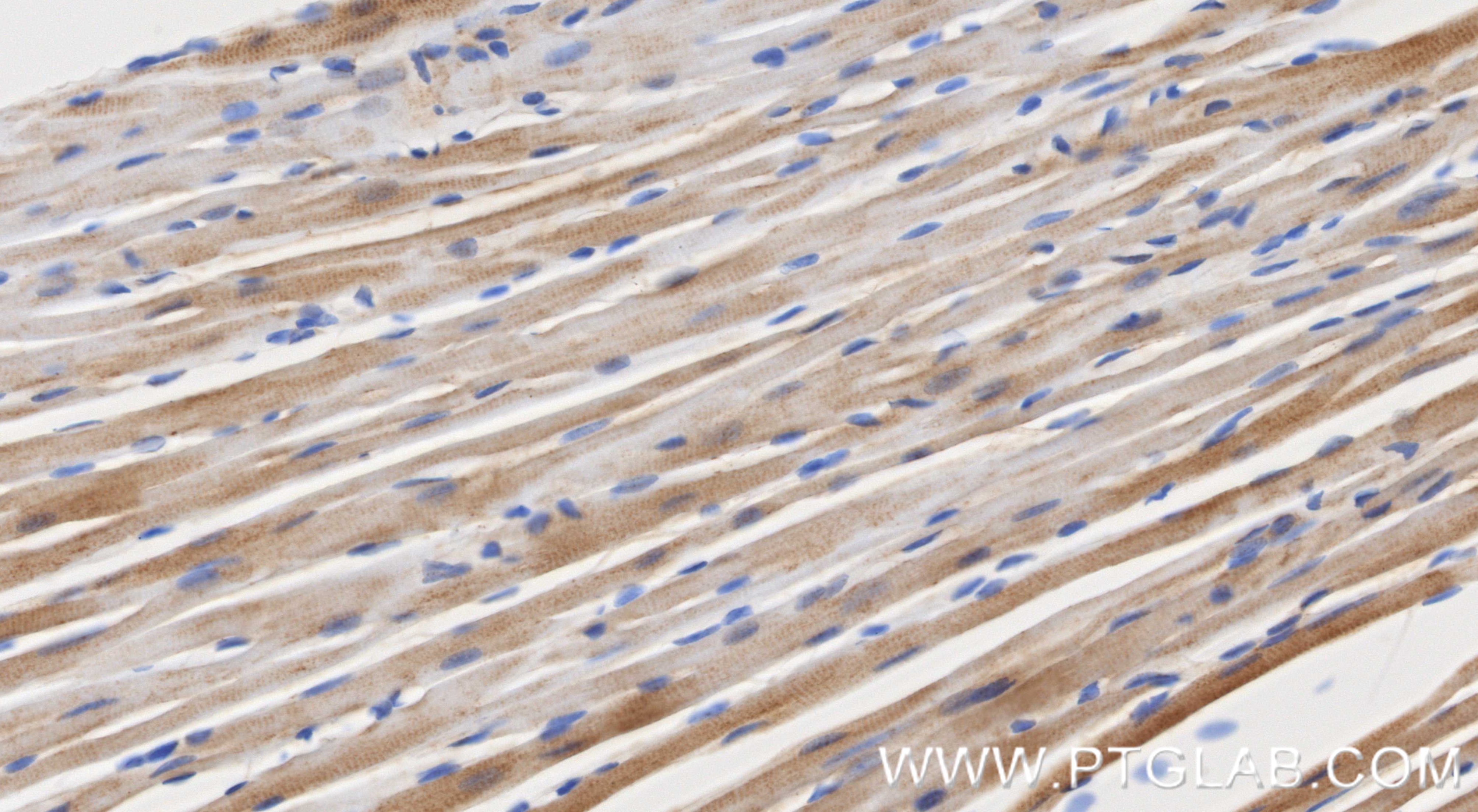 IHC staining of mouse heart using 87199-1-RR