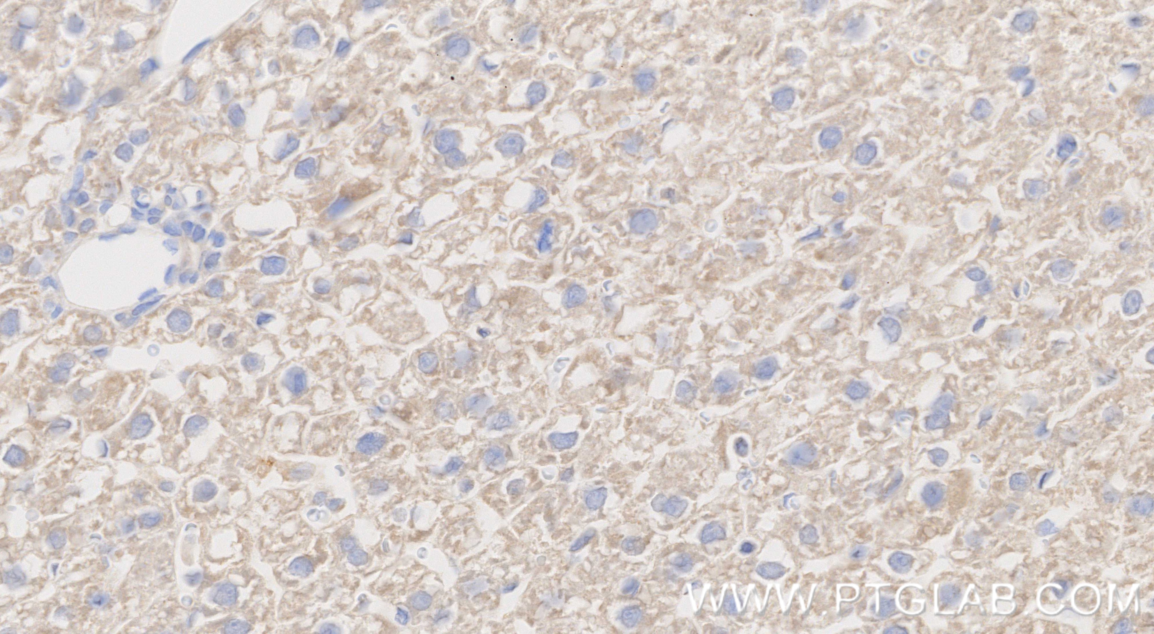 IHC staining of rat liver using 87199-1-RR
