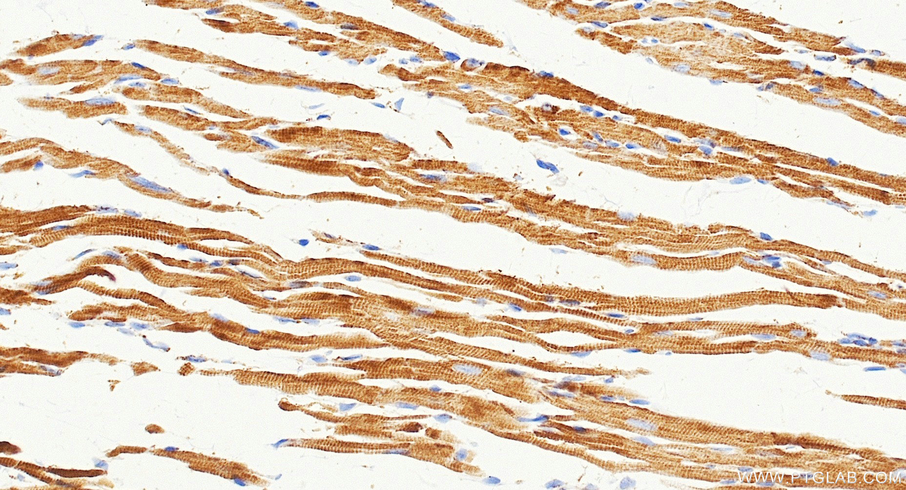 IHC staining of mouse heart using Biotin-87199 IHC staining of mouse heart using Biotin-87199