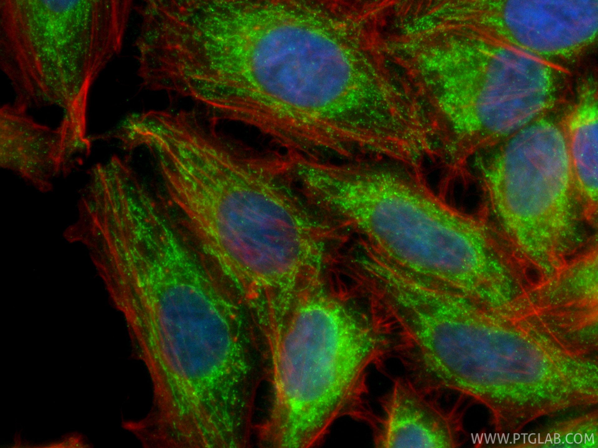 IF Staining of HepG2 using CL488-87199 IF Staining of HepG2 using CL488-87199