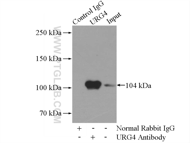 IP experiment of HEK-293 using 11998-1-AP