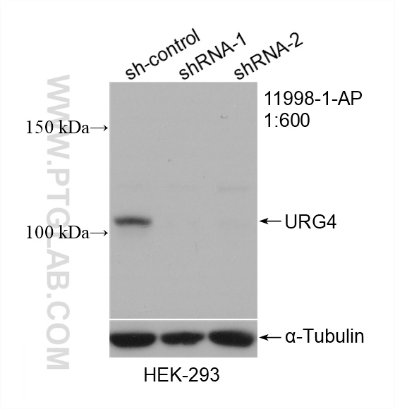 WB analysis of HEK-293 using 11998-1-AP