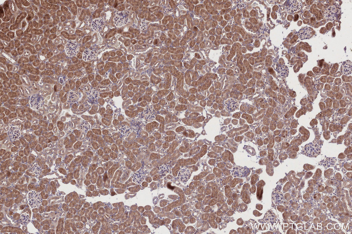 IHC staining of mouse kidney using 67144-1-Ig IHC staining of mouse kidney using 67144-1-Ig
