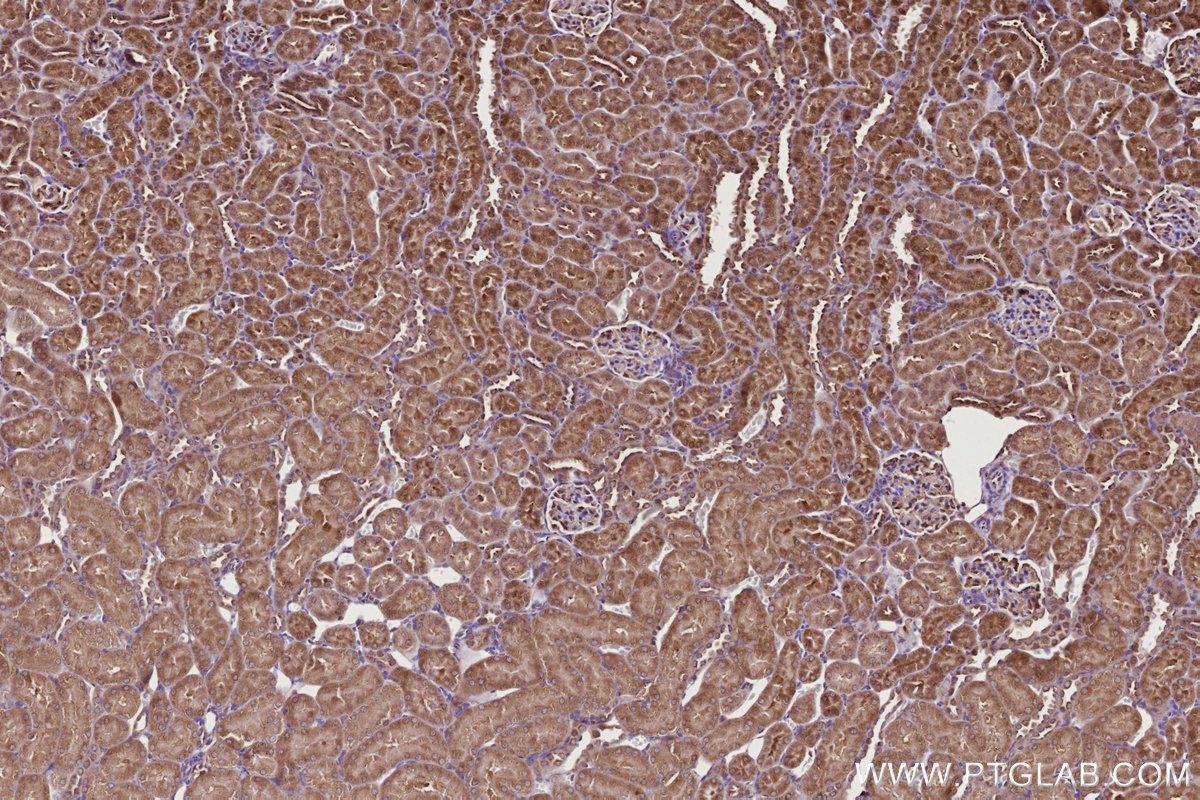 IHC staining of rat kidney using 67144-1-Ig IHC staining of rat kidney using 67144-1-Ig