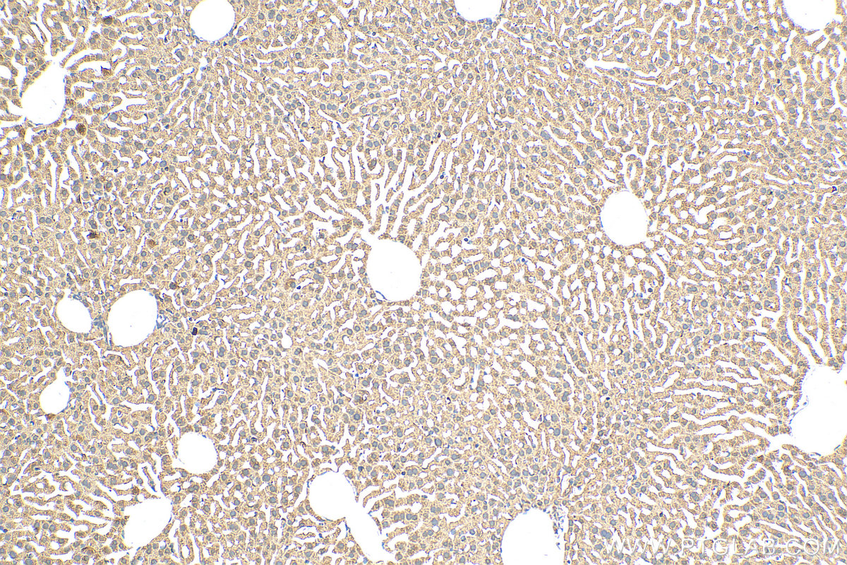 IHC staining of mouse liver using 15285-1-AP