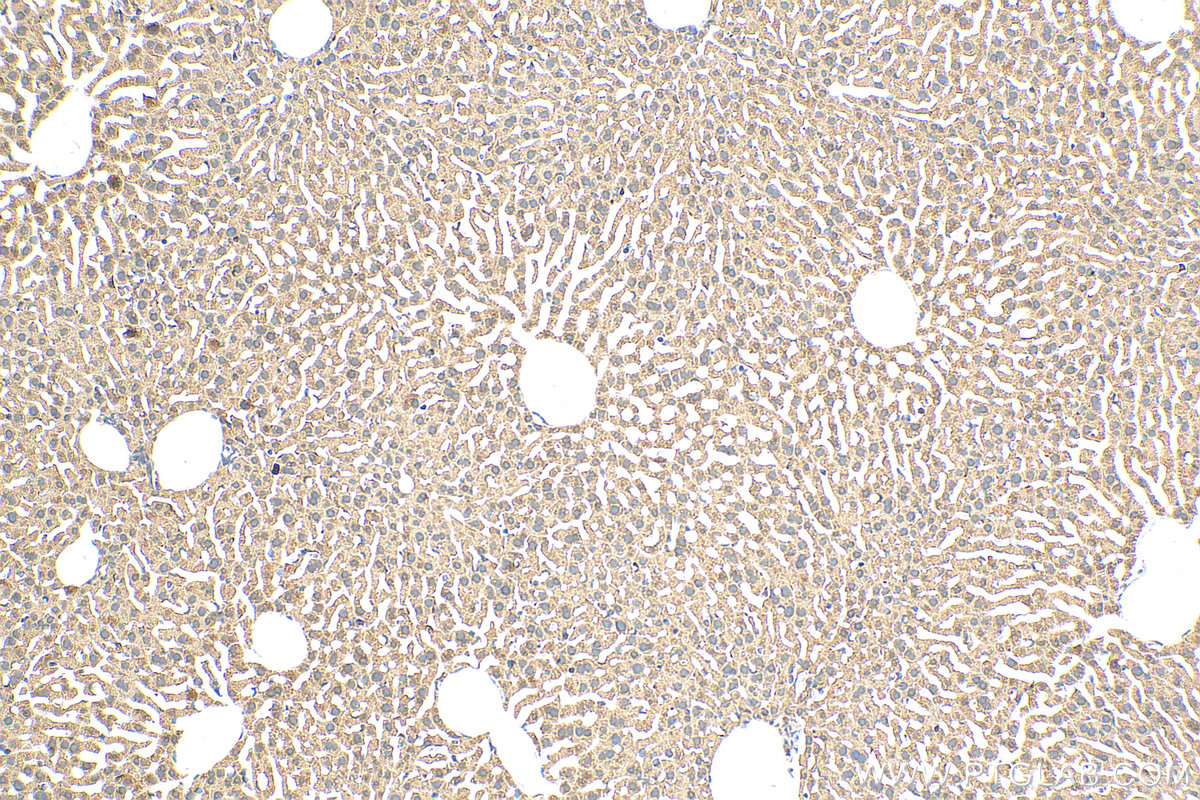 IHC staining of mouse liver using 15285-1-AP