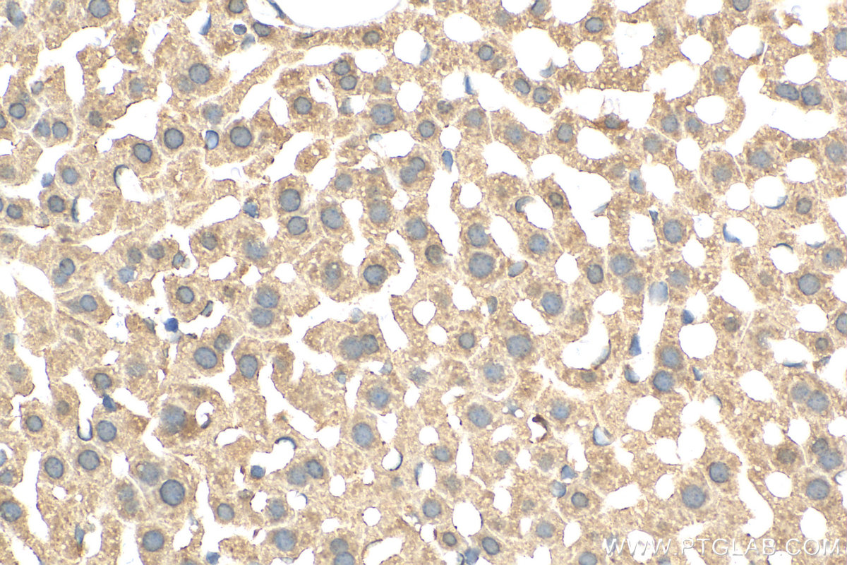 IHC staining of mouse liver using 15285-1-AP