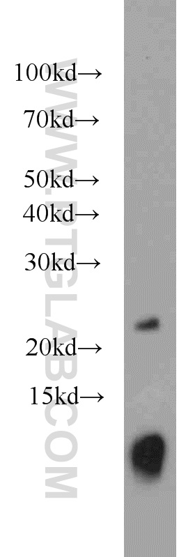 WB analysis of human placenta using 15285-1-AP