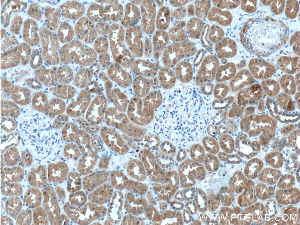 IHC staining of human kidney using 15547-1-AP