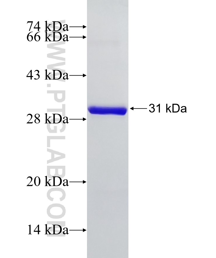 USE1 fusion protein Ag18597 SDS-PAGE USE1 fusion protein Ag18597 SDS-PAGE