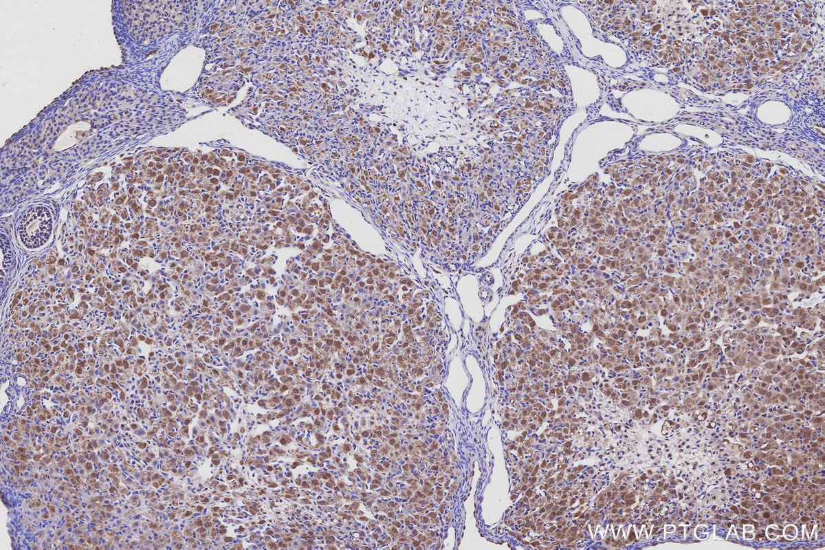 IHC staining of rat ovary using 11358-1-AP
