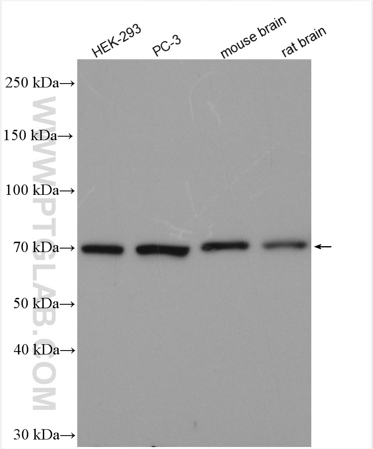 WB analysis using 11358-1-AP