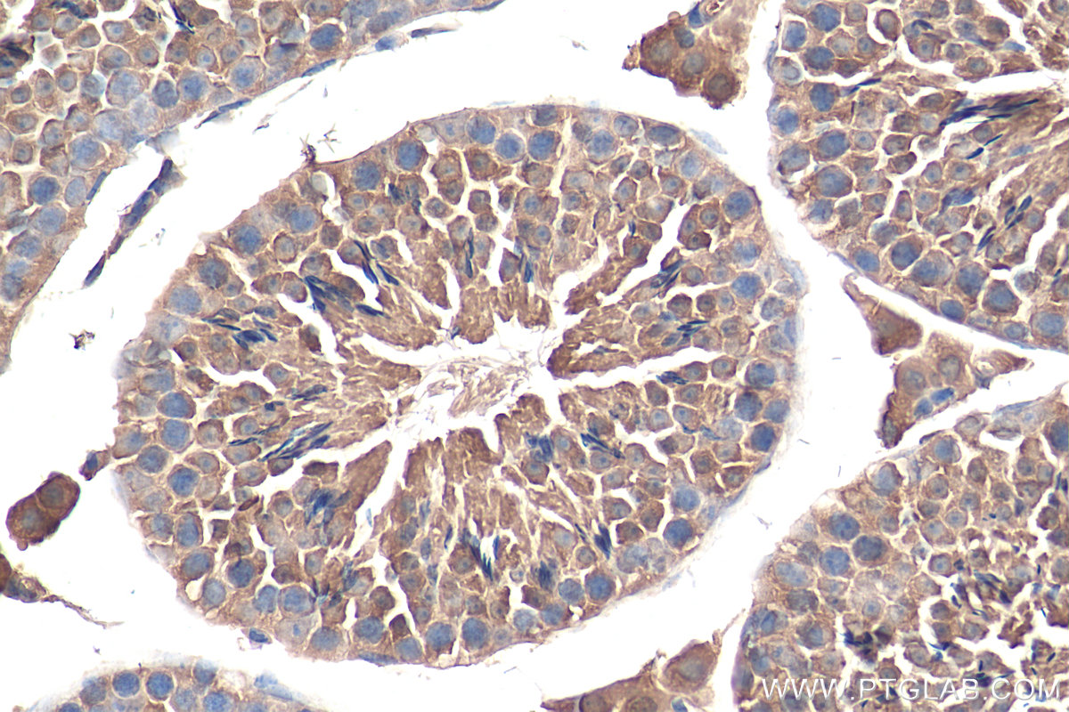 IHC staining of mouse testis using 21936-1-AP