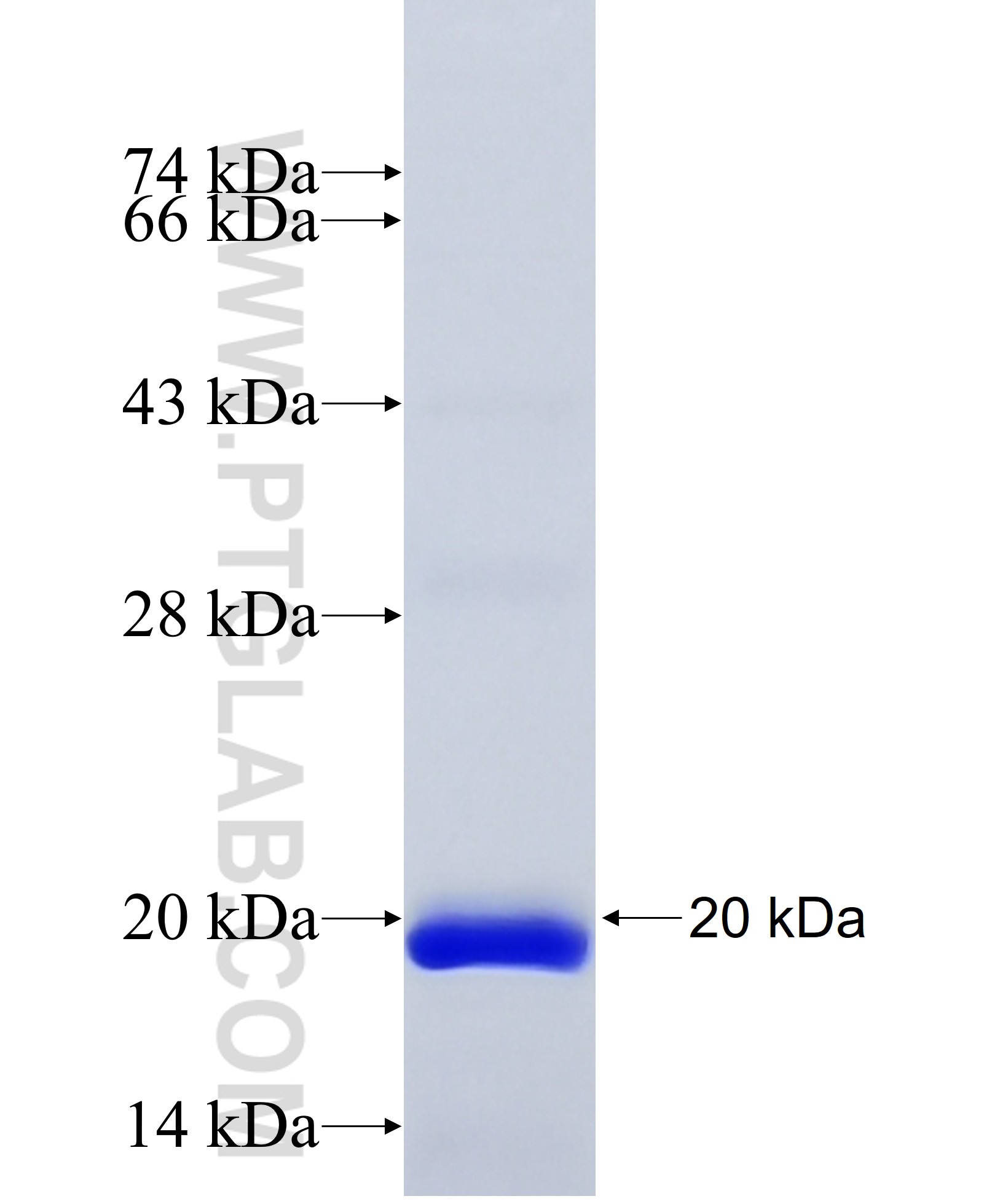 USH2A fusion protein Ag31270 SDS-PAGE USH2A fusion protein Ag31270 SDS-PAGE