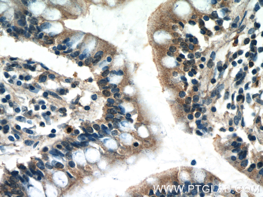 IHC staining of human small intestine using 17226-1-AP