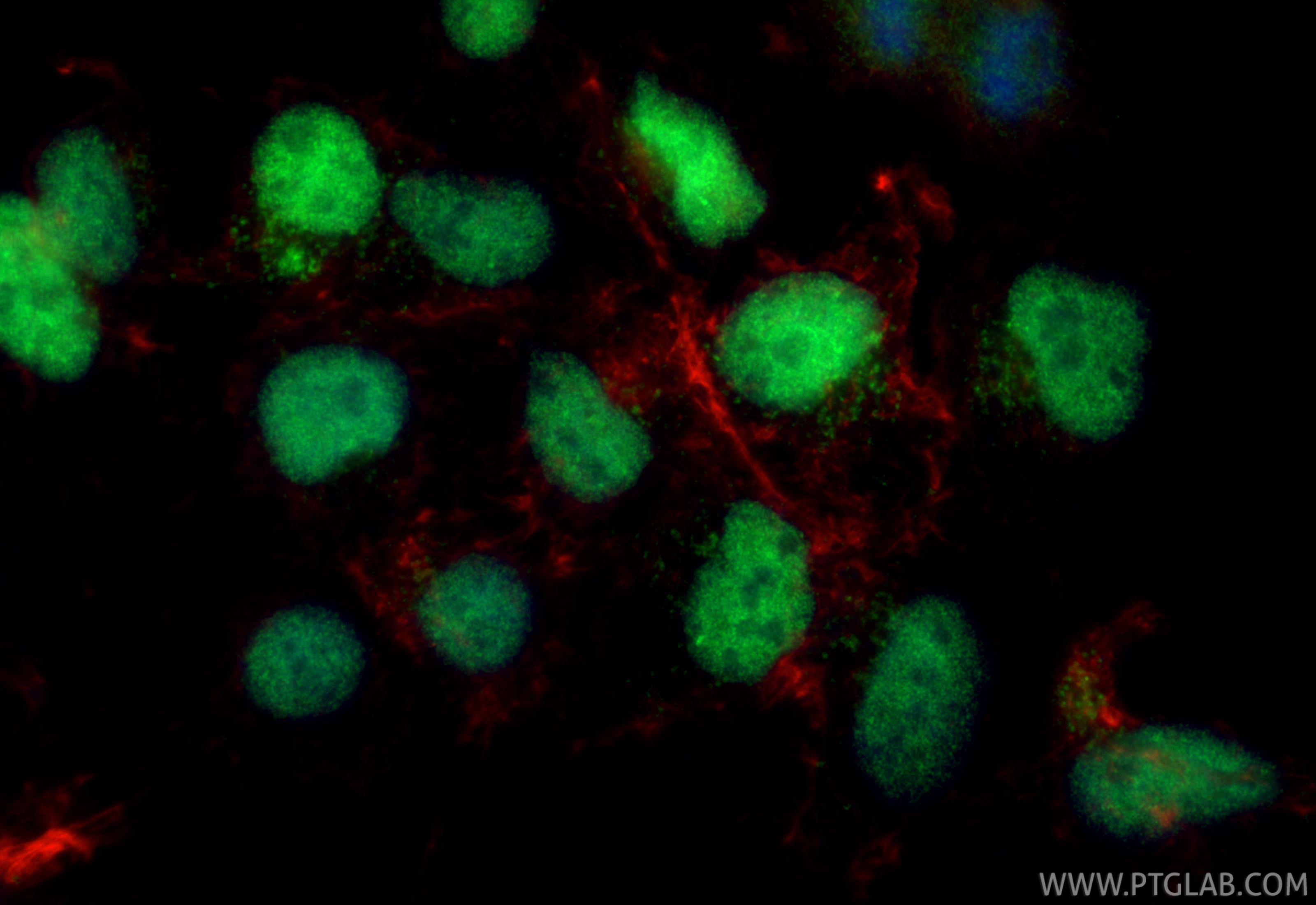 IF Staining of HEK-293 using 14346-1-AP IF Staining of HEK-293 using 14346-1-AP