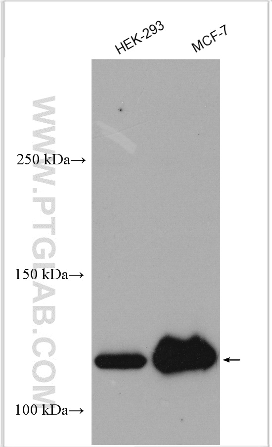 WB analysis using 19374-1-AP