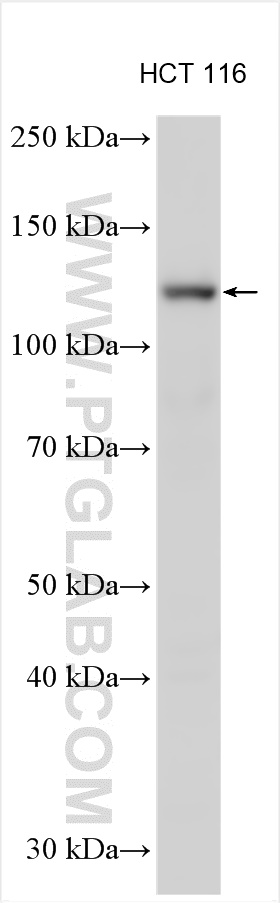 WB analysis using 19374-1-AP