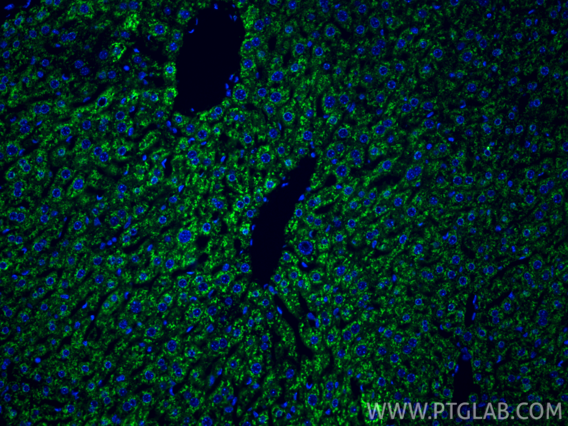 Immunofluorescent analysis of (4% PFA) fixed paraffin-embedded mouse liver tissue using USP10 antibody (<a class='green' href='/productredirect?CatalogNo=67917-1-Ig' target='_blank'>67917-1-Ig</a>, Clone: 1B10C9 ) at dilution of 1:400 and CoraLite®488-Conjugated Goat Anti-Mouse IgG(H+L) (<a class='green' href='/productredirect?CatalogNo=SA00013-1' target='_blank'>SA00013-1</a>). Heat mediated antigen retrieval with Tris-EDTA buffer (pH 9.0). This data was developed using the same antibody clone with 67917-1-PBS in a different storage buffer formulation. IF Staining of mouse liver using 67917-1-Ig (same clone as 67917-1-PBS)