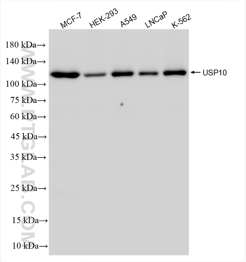 WB analysis using 81435-2-RR (same clone as 81435-2-PBS)