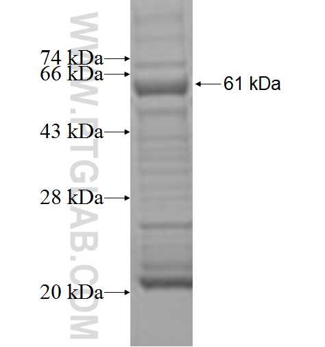 USP10 fusion protein Ag7106 SDS-PAGE USP10 fusion protein Ag7106 SDS-PAGE