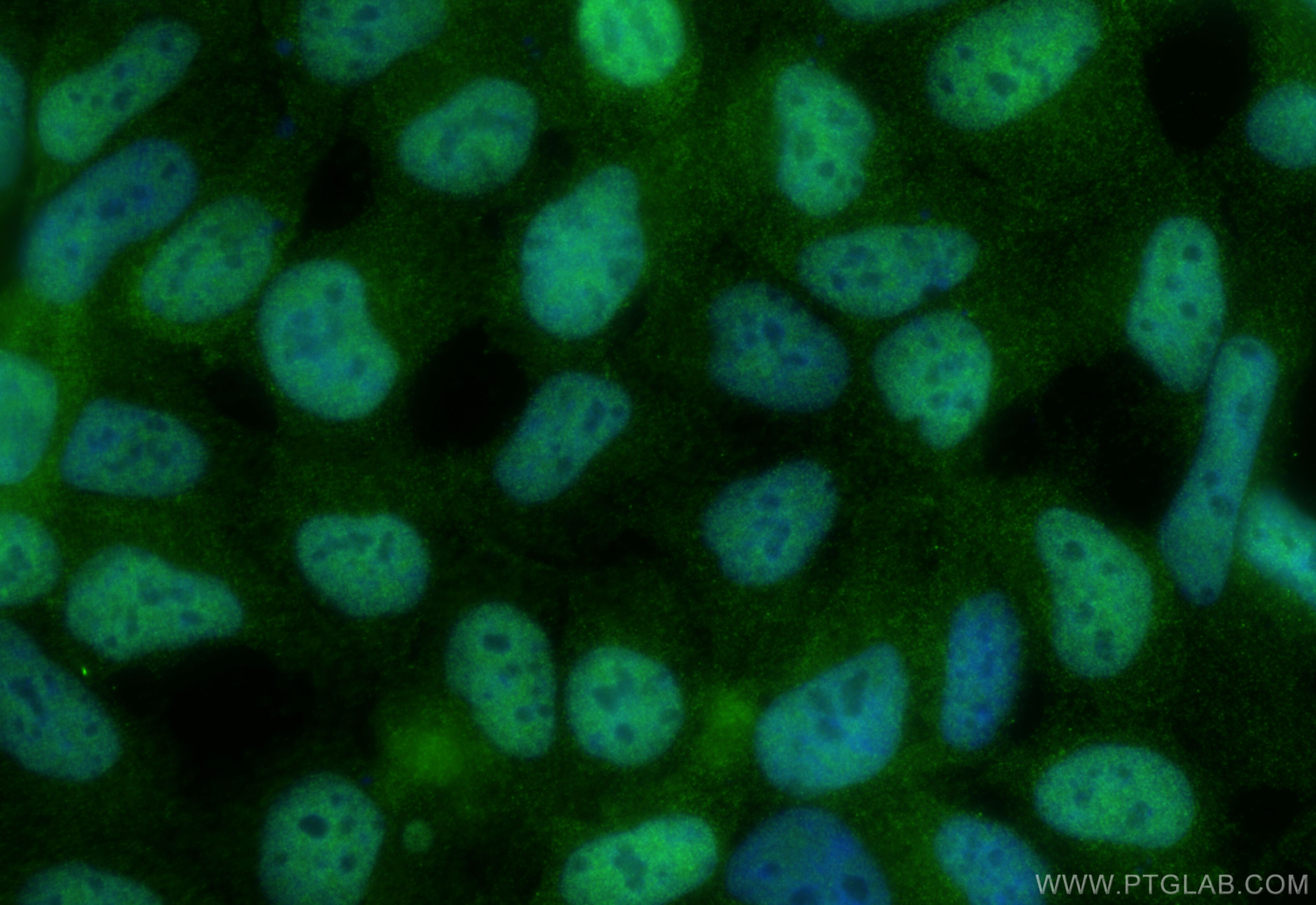 IF Staining of HEK-293 using 22340-1-AP (same clone as 22340-1-PBS)
