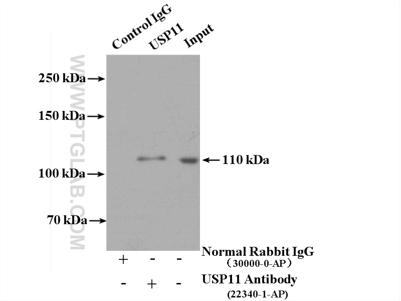 IP experiment of HEK-293 using 22340-1-AP (same clone as 22340-1-PBS)