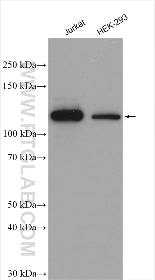 WB analysis using 22340-1-AP