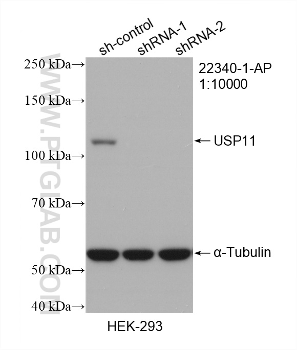 WB analysis of HEK-293 using 22340-1-AP (same clone as 22340-1-PBS)
