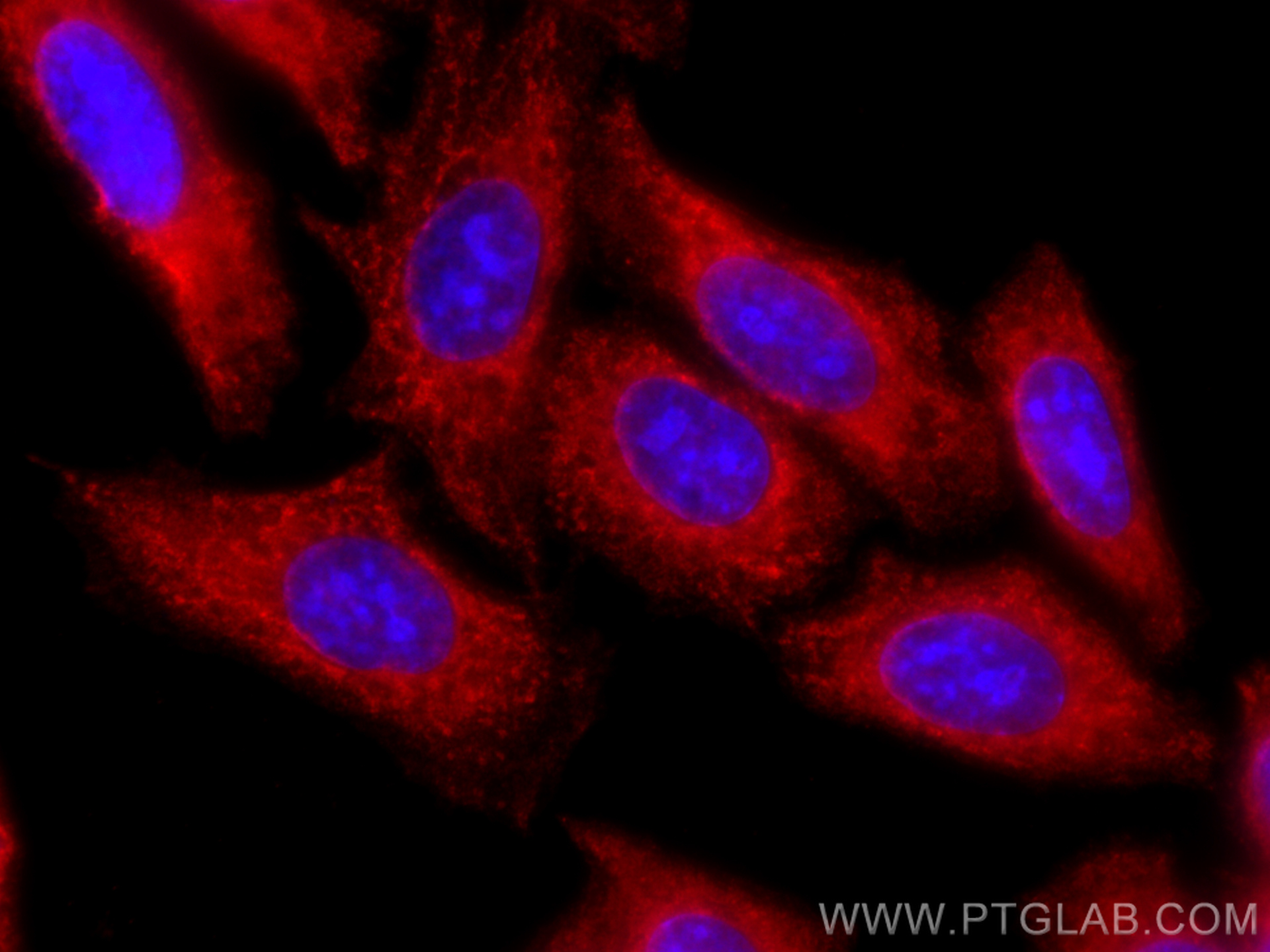 IF Staining of HepG2 using CL594-67805