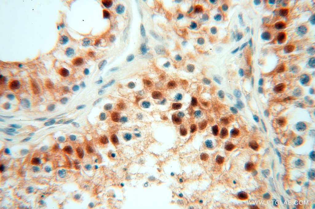 IHC staining of human testis using 16840-1-AP