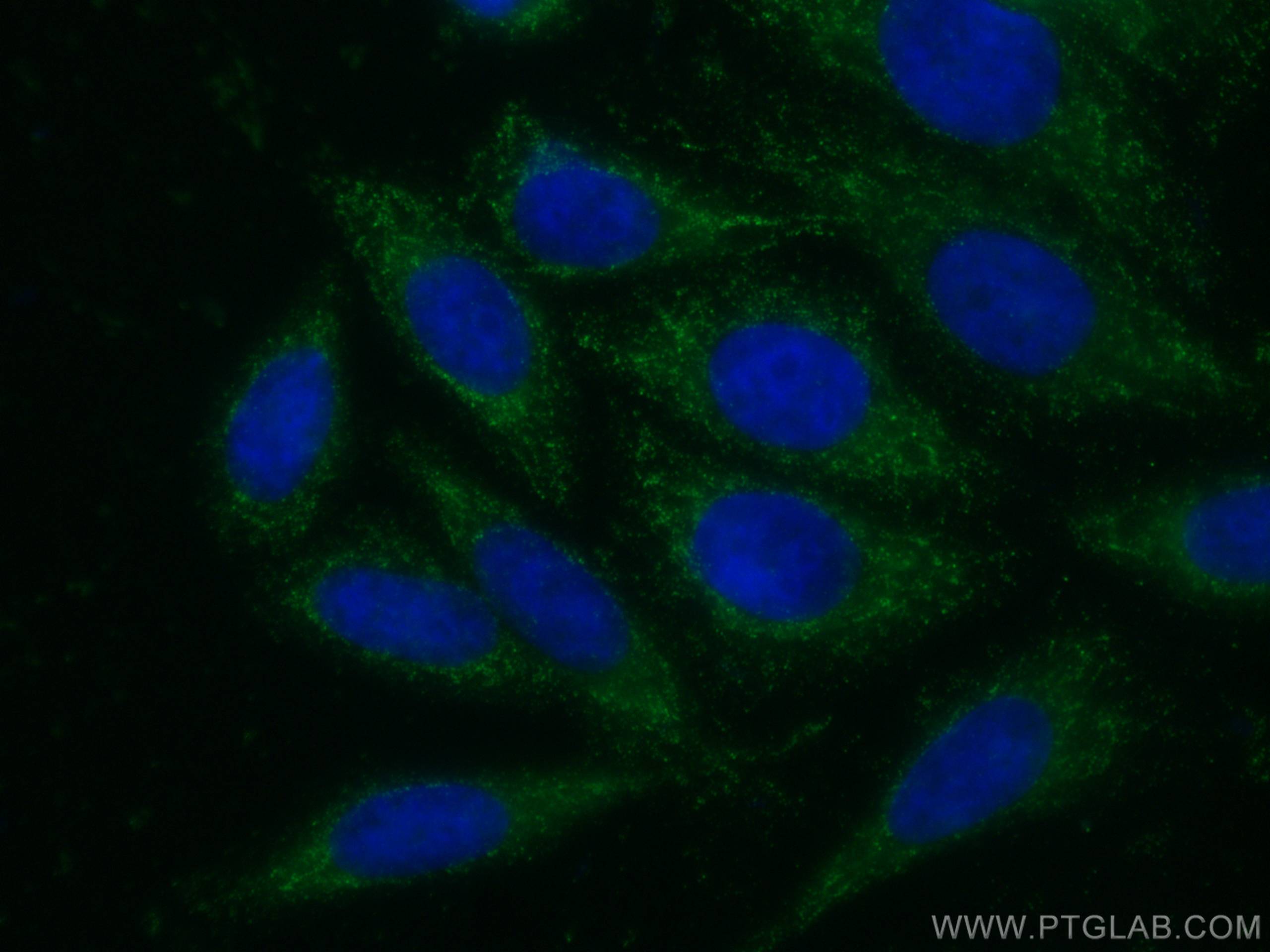 IF Staining of HepG2 using 66176-1-Ig (same clone as 66176-1-PBS)