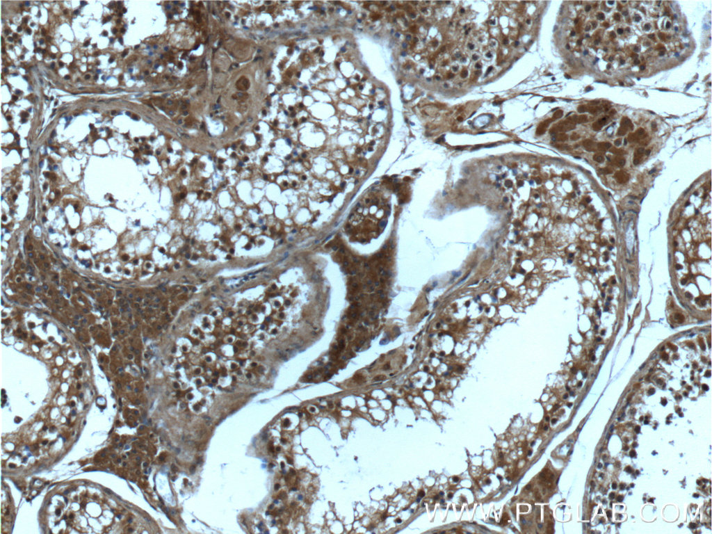 IHC staining of human testis using 66176-1-Ig (same clone as 66176-1-PBS)