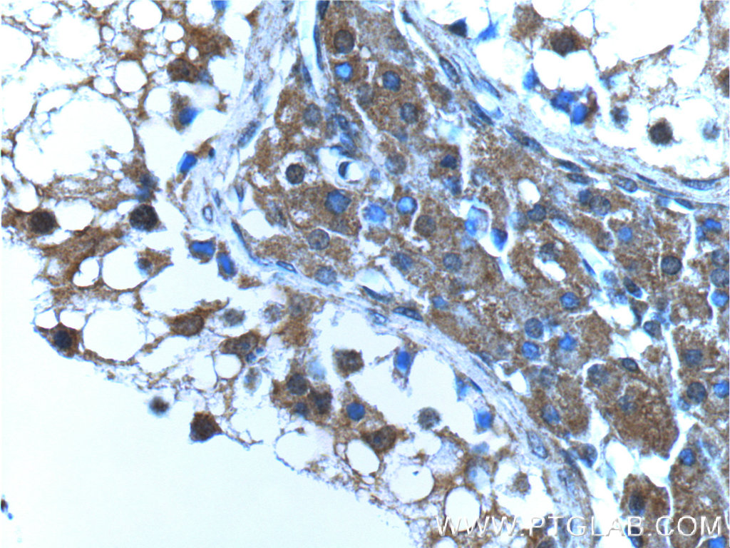 IHC staining of human testis using 66176-1-Ig (same clone as 66176-1-PBS)