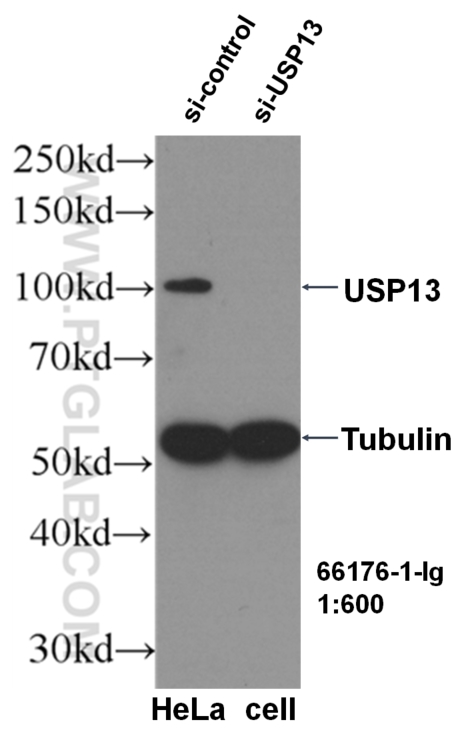 WB analysis of HeLa using 66176-1-Ig (same clone as 66176-1-PBS)