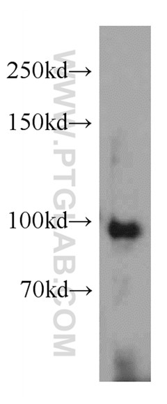 WB analysis of HepG2 using 66176-1-Ig (same clone as 66176-1-PBS)