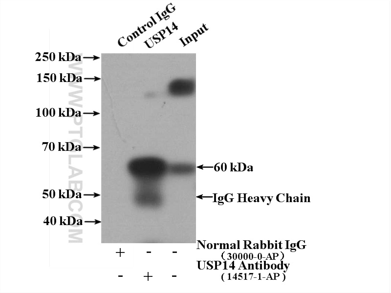 IP experiment of mouse liver using 14517-1-AP